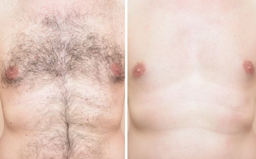 Hair Removal Cream